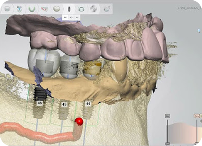 3D CT