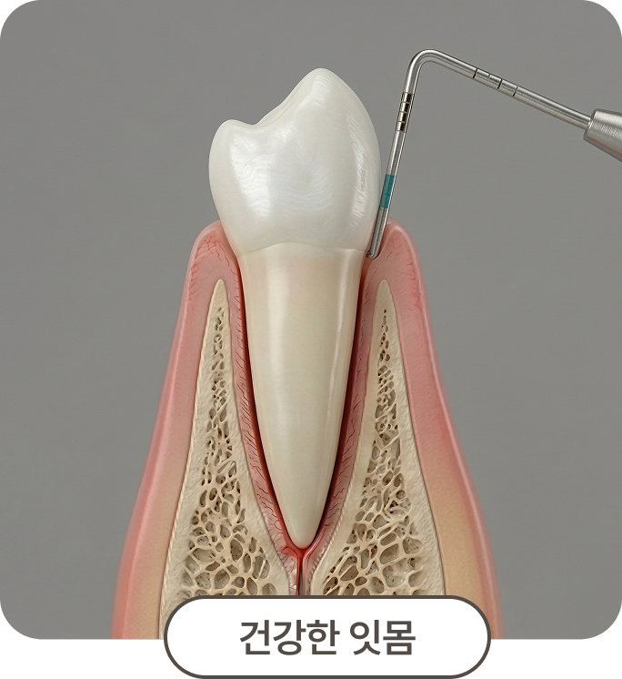 건강한 잇몸